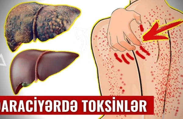 Qaraciyəri Piyləndirən Budur! - İnsanların 90%-i Bunu Bilmir