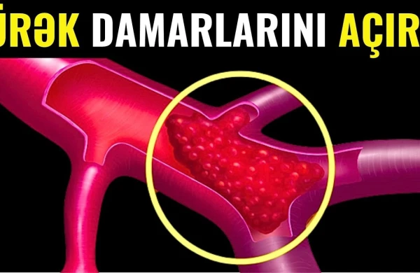 Bu qida ürəyə gedən damarları 5 qəqiqəyə təmizləyir (VİDEO)