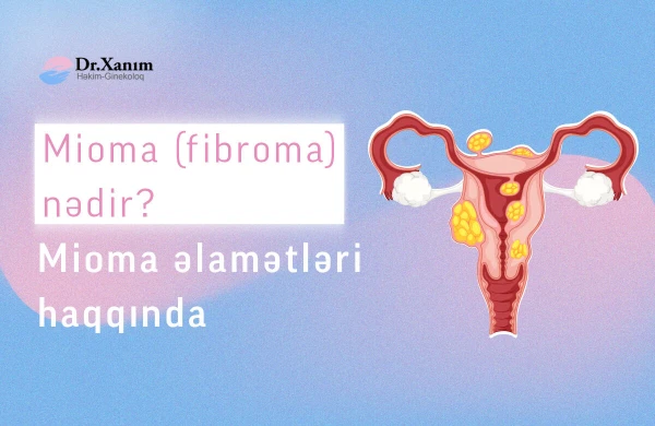 Mioma (Fibroma) və əlamətləri haqqında bilmədikləriniz - Ginekoloq Xanım Adıgözəlova