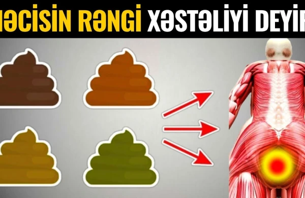 Nəcisin rəngi bu xəstəlikdən xəbər verirmiş - VİDEO