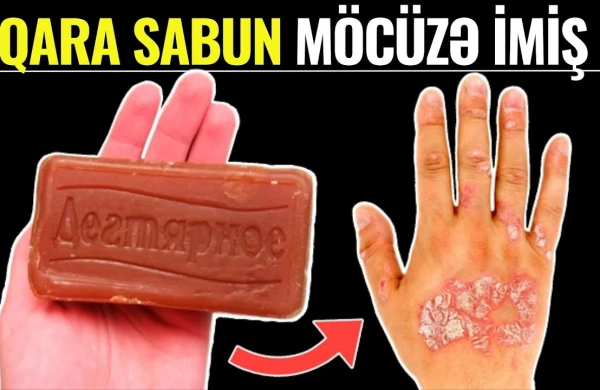 QARA SABUN Görün Nələrə Çarəymiş! - 90% İnsan BUNU BİLMİR