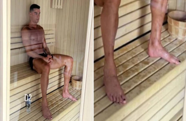 Ronaldo dırnağına niyə lak çəkir? - ŞOK SƏBƏB