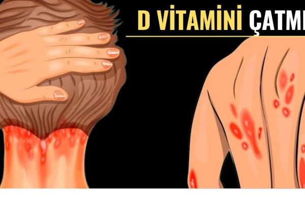 D vitamini çatışmazlığının vacib əlamətləri BUNLARDIR