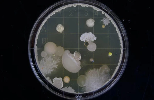 Antibiotiklərə "meydan oxuyan" dərman hazırlandı