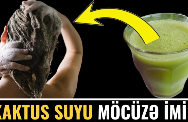 Saçınızı 1 ay Kaktus Suyu ilə yusanız, nə olar? - Kəpək gedir, saç uzanır və...