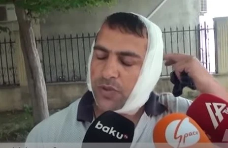 Qulağını eşşək qopardan kişi görün kimdir   —  VİDEO