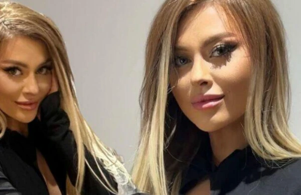 İlqarənin yeni görünüşü təəccübləndirdi - FOTO