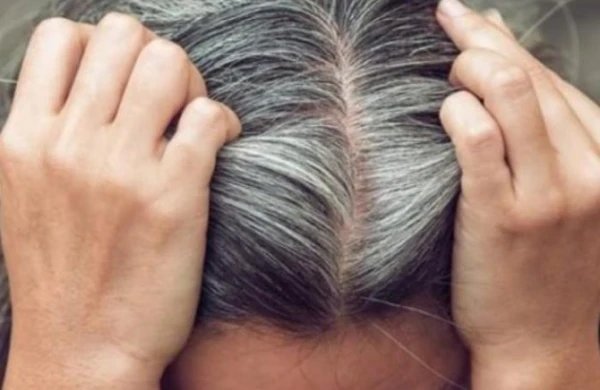 Saçlarımız niyə vaxtından tez ağarır? - Xəstəlik ola bilər…