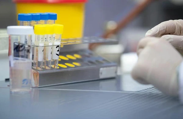 İranda bu virus yayılır - Artıq 3 nəfər ölüb