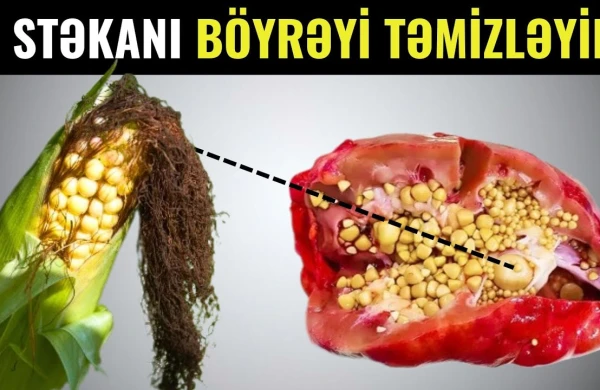 Dərmansız Böyrək Daşlarını Təmizləyin - Hər səhər için