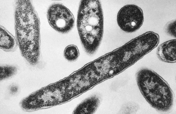 Polşada legionella bakteriyasından ölənlərin sayı 11-ə çatıb