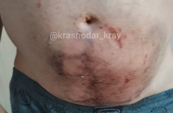 İt kişinin qarnın parçaladı