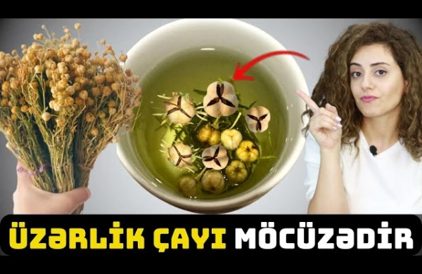 Üzərliyi Suya Töküb Qaynadın - NƏTİCƏ İNANILMAZDIR