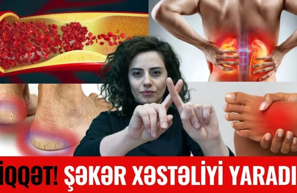 Bu Qidaları Yeyən ŞƏKƏR XƏSTƏSİ Olur - ŞOK