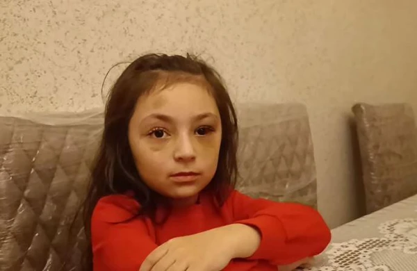 “Direktor maddiyyatla həll etmək istəyirdi” – Döyüldüyü deyilən məktəblinin ANASI – VİDEO