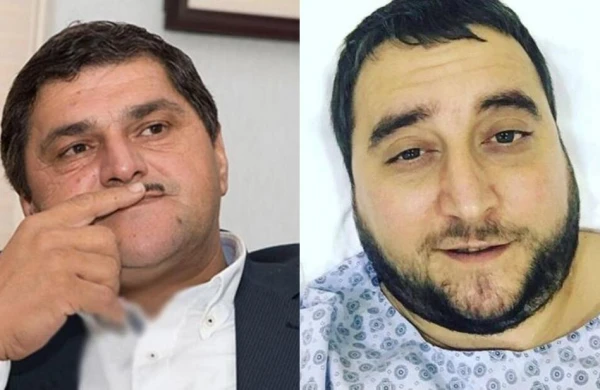 İkisinin də vəziyyəti yaxşı deyil