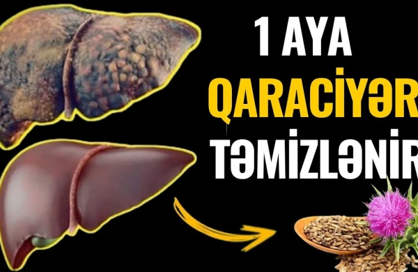Qaraciyərin XƏSTƏ olduğunu göstərən 10 VACİB ƏLAMƏT