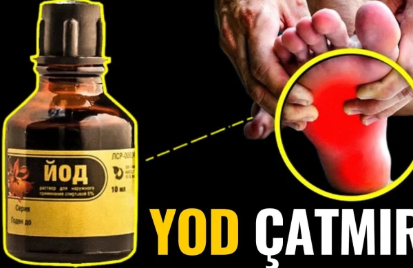 Bədəndə YOD Azlığının 11 VACİB ƏLAMƏTİ - BUNU EDİN!