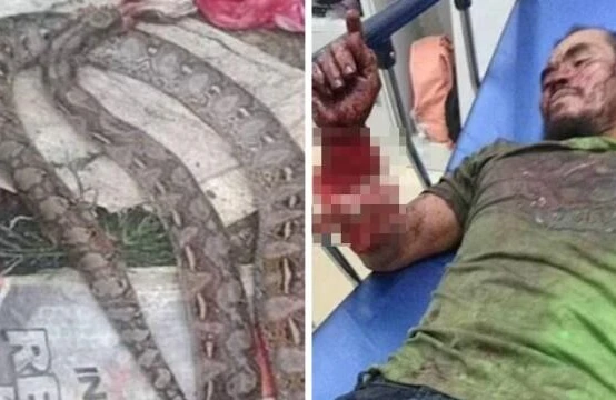 Kişi ilanı dişləyərək belə öldürdü - VİDEO - FOTO