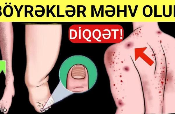 Bağırsaqları İllərin Zibilindən Təmizləyəcək - Təbii Yolla Müalicə