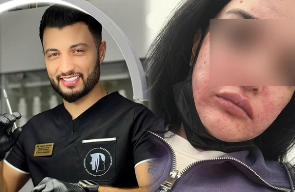Bakıda şok! Bərbər kosmetoloq adı ilə klinikada  işləyir?  —   FOTOLAR 