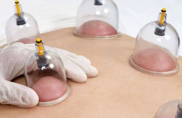 Bu şəxslərə hicama qətiyyən olmaz - XƏBƏRDARLIQ&nbsp;&nbsp;