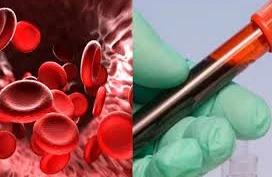 Qanımızı azaldan səbəblər