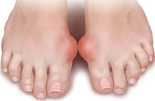 Podaqradan əziyyət çəkirsinizsə...