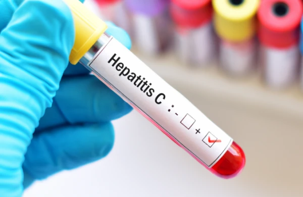 "Hepatit C" xəstəliyi ilə&nbsp; bağlı həkim XƏBƏRDARLIQ EDİR