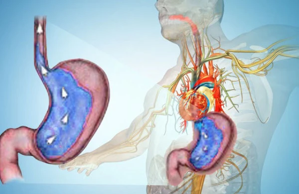 Mədə ilə ürək ağrısını necə seçək?&nbsp; —&nbsp; &nbsp;Bu yolla ayırd etmək mümkdündür