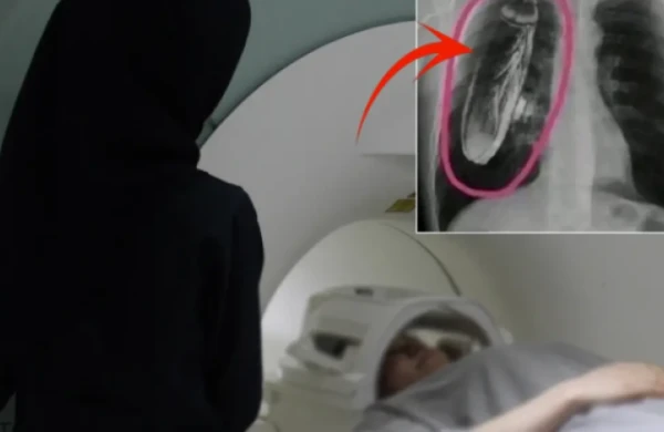 Bədənində "canlı tarakan var" dedilər, həqiqət isə başqa imiş - FOTO  