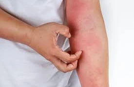 DİQQƏT! Ölümcül xəstəliyiniz varsa, bədəndə bu dəyişikliklər baş verir&nbsp;