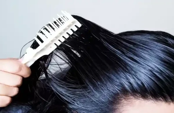 Yağlı seboreya saç tökülməsini sürətləndirə bilər – mütəxəssis xəbərdarlığı&nbsp;&nbsp;