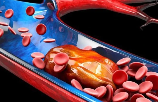 Damarlarımızı içəridən nə zədələyir?&nbsp;&nbsp;