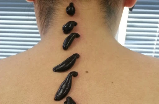  Zəli terapiyası kimlərə tətbiq edilməlidir? – FAYDALARI NƏLƏRDİR?