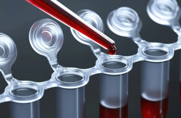 Yüksək CRP nə deməkdir? – Orqanizmin “SOS siqnalı” nəyi göstərir&nbsp;&nbsp;