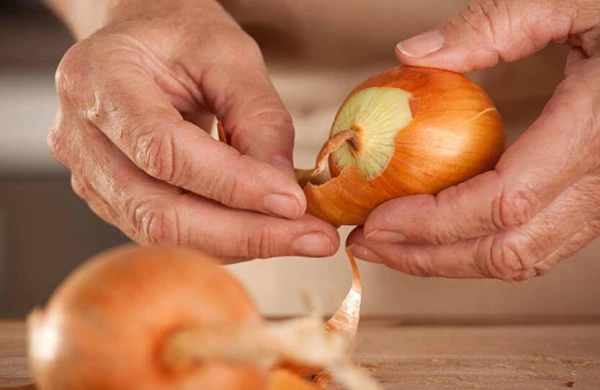 Həkim: “Soğan qabığı ilə bağlı iddialar elmi müalicə kimi qəbul edilməməlidir”&nbsp;&nbsp;