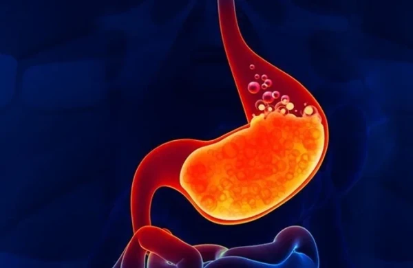 Reflüks xəstəliyi öskürəyə səbəb ola bilərmi?&nbsp; &nbsp;