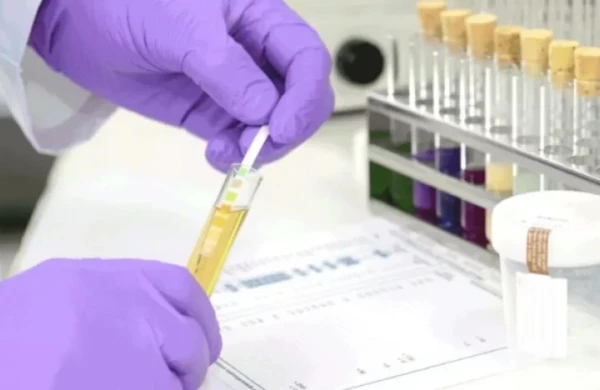 Bu şəxslərdən məcburi narkoloji test TƏLƏB OLUNACAQ