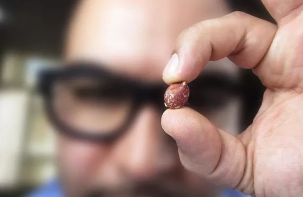 &nbsp;“Bulanıq görmə” bu xəstəlikdən xəbər verirmiş