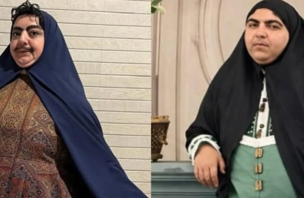 "Komedixana" bu obrazla rekord qırdı   — "Bığlı gözəl" KİMDİR?
