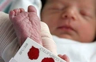 Daban testi nədir və nə üçün vacibdir? — Nevroloqdan valideynlərə XƏBƏRDARLIQ&nbsp;&nbsp;