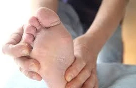 Dermatoloqlardan göbələklə bağlı XƏBƏRDARLIQ