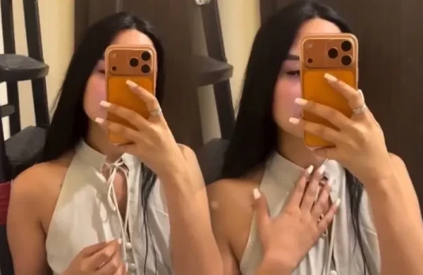 Bloger botoksdan sonra qolunun iflic olduğunu deyir