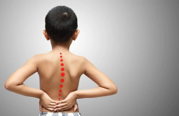 Skoliozu evdə təyin etmək mümkündürmü? – Mütəxəssisdən VALİDEYNLƏRƏ MÜHÜM XƏBƏRDARLIQ&nbsp;&nbsp;