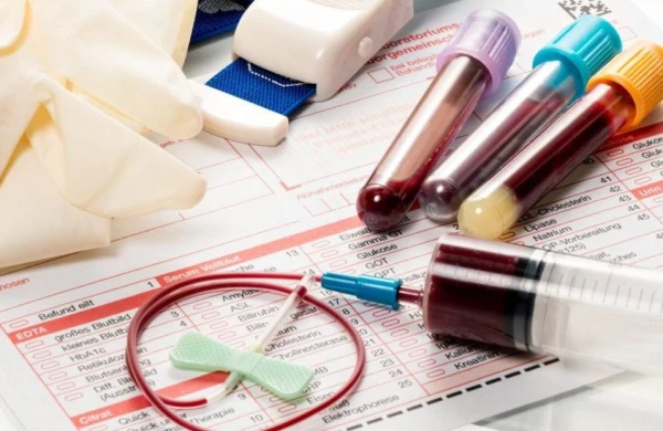 Qan analizində trombositlərin az çıxması nəyin göstəricisidir? — Pediatr-hematoloqdan xəbərdarlıq&nbsp;&nbsp;