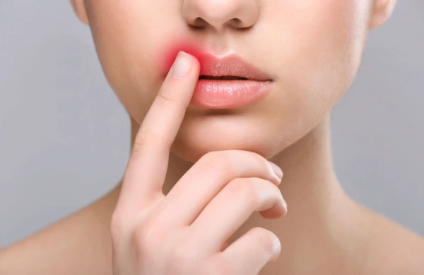 Kəmərvari ağrıların müəmmalı səbəbi: Herpes virusu sinirləri necə zədələyir? – Alqoloqdan XƏBƏRDARLIQ&nbsp;&nbsp;