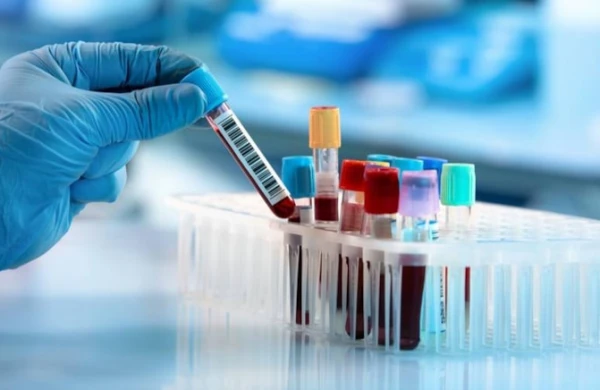 Alzheimer xəstəliyinin erkən diaqnozunda inqilab