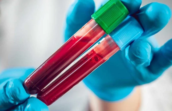 Qanınızın çox olması ağır xəstəlik göstəricisi ola bilər! – Orqanizmdəki təhlükəli siqnallar&nbsp;&nbsp;