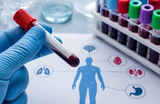 Trigliserid yüksək çıxıbsa, bu nə deməkdir? – Kardioloqdan açıqlama&nbsp;&nbsp;